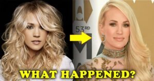 Read more about the article The Untold Story Behind Carrie Underwood Plastic Surgery Rumors: What Really Happened?