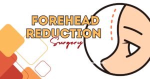 Read more about the article 10 Amazing Benefits of Forehead Reduction Surgery You Should Know