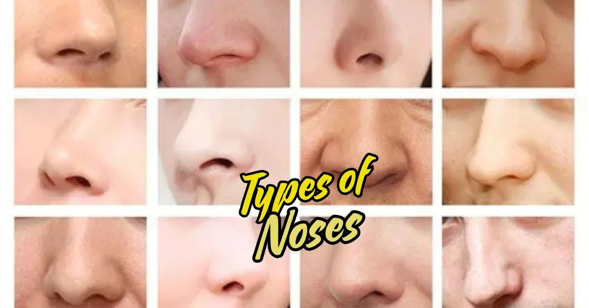 Types of Noses