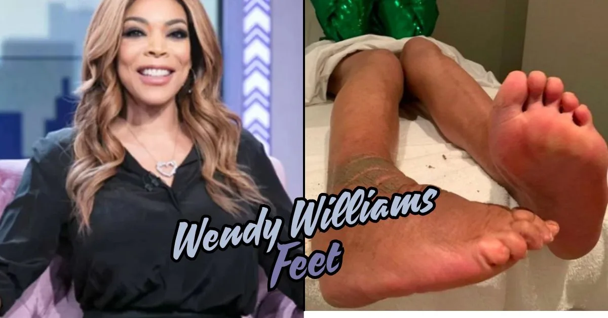 wendy williams feet