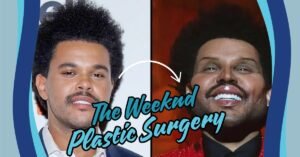 Read more about the article The Weeknd Plastic Surgery: Unveiling His Stunning Transformation