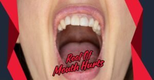 Read more about the article Why Does the Roof of Mouth Hurts? Common Causes and Solutions