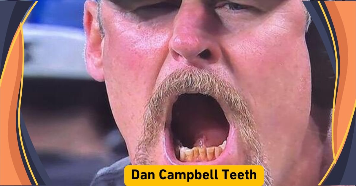 dan campbell teeth