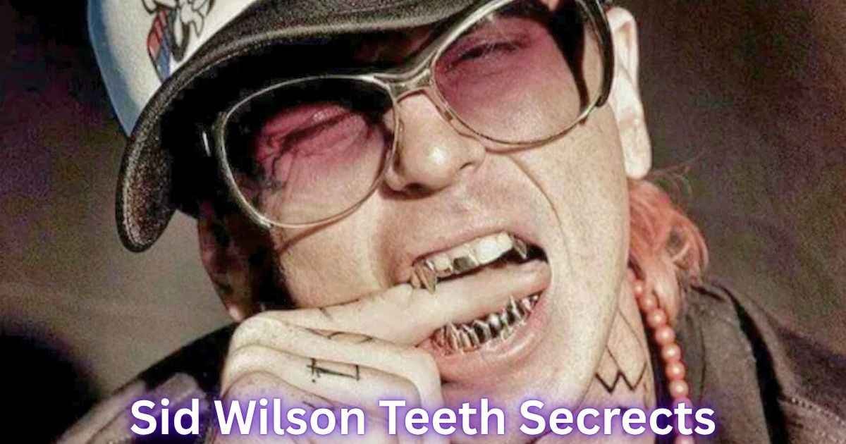 Sid Wilson Teeth